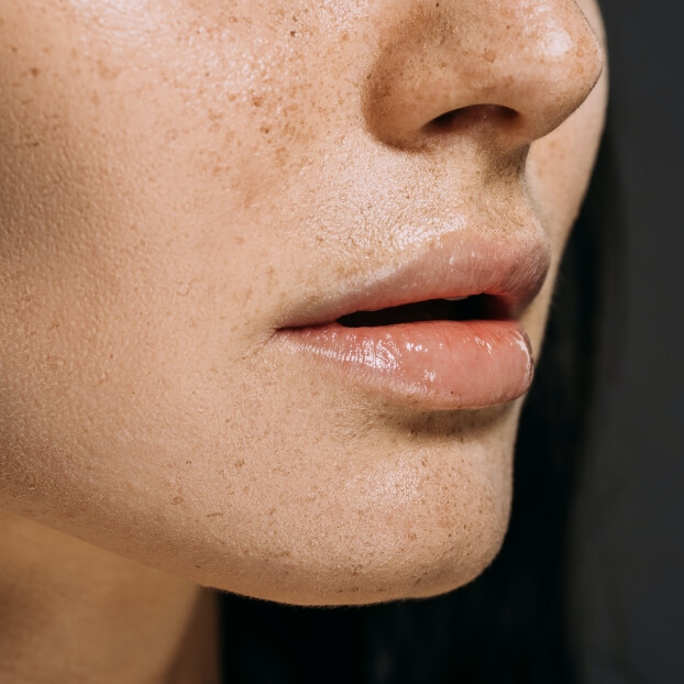 Skincare